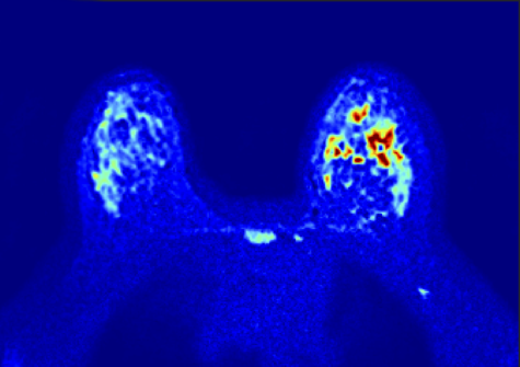 Diffusion biomarkers