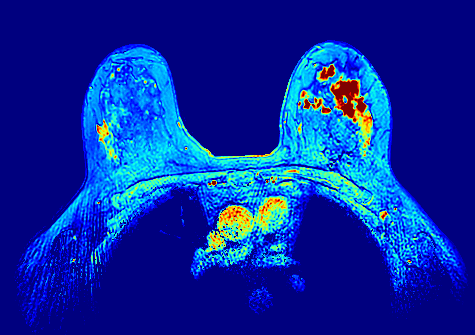Perfusion biomarkers
