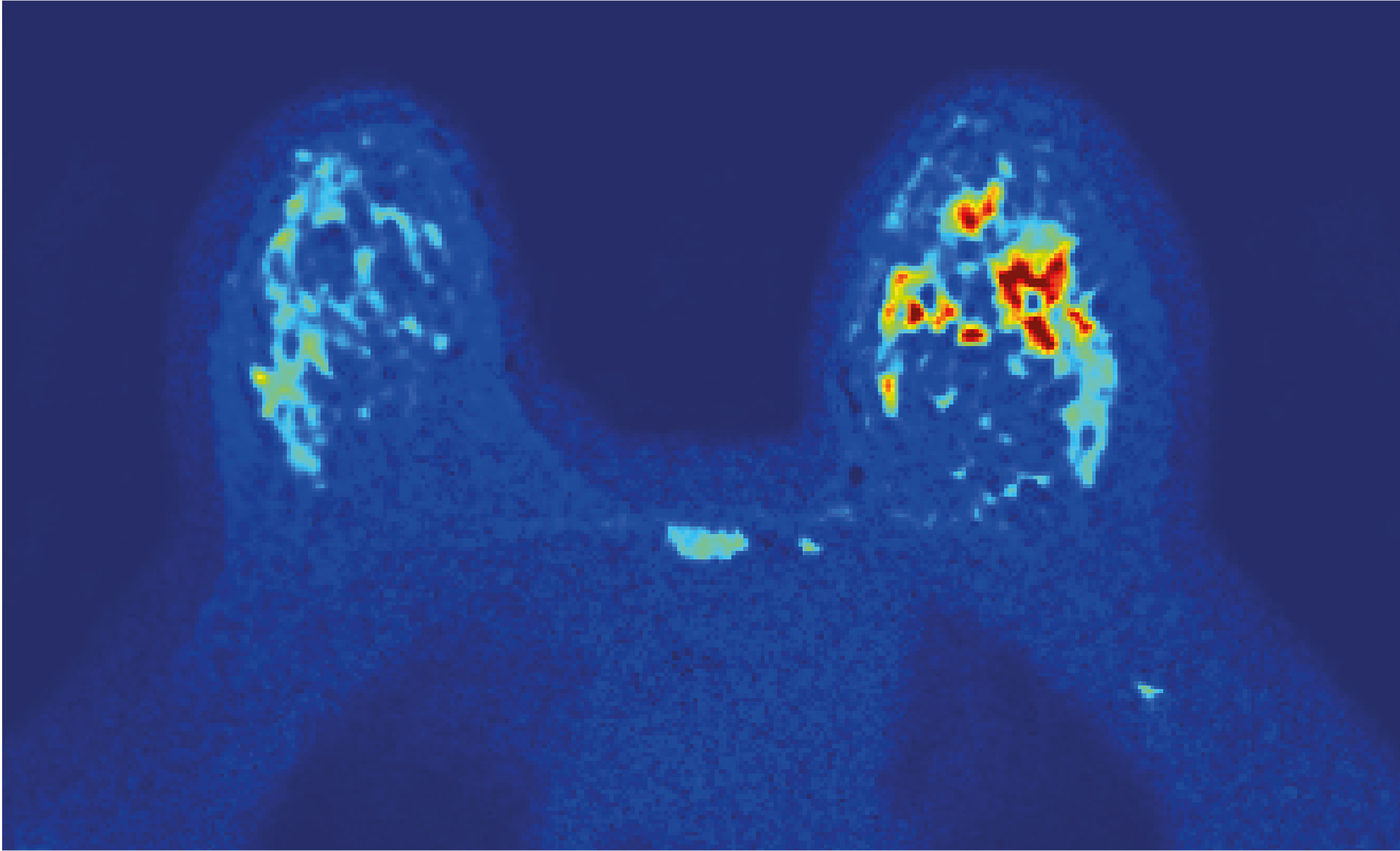 Diffusion biomarkers