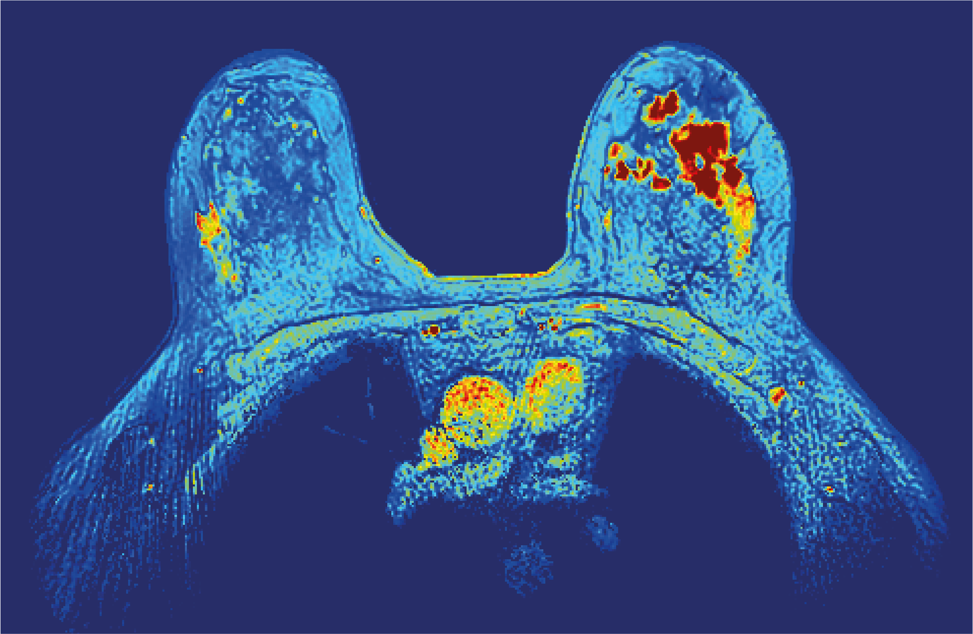 Perfusion biomarkers