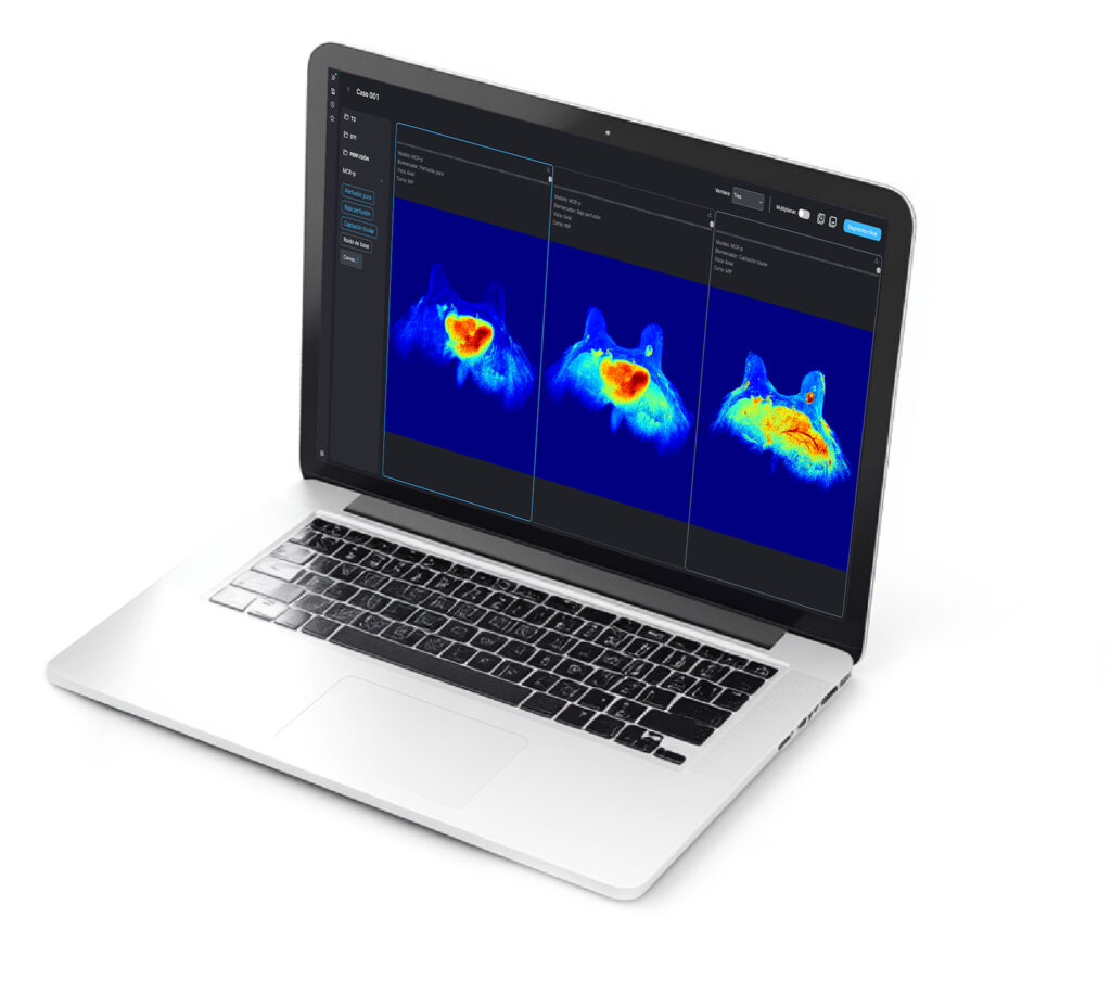 Multiparametric MRI
