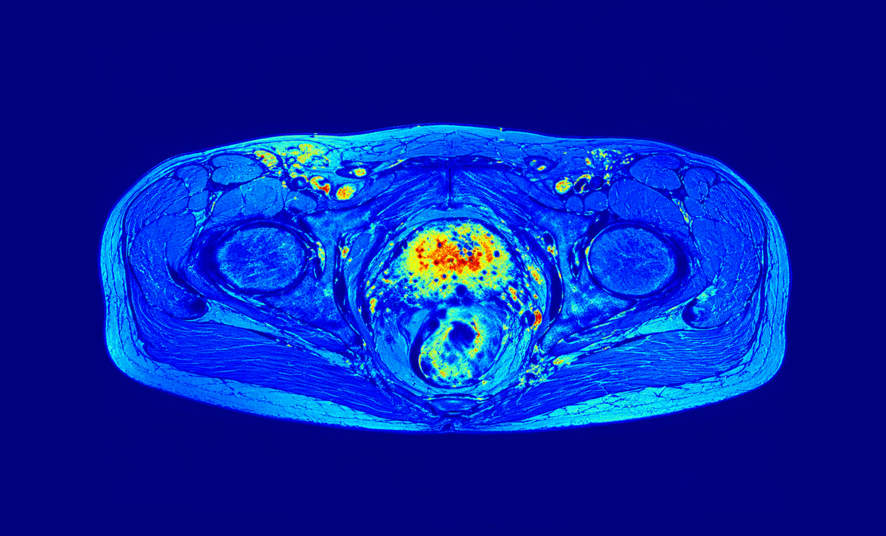 Perfusion biomarkers